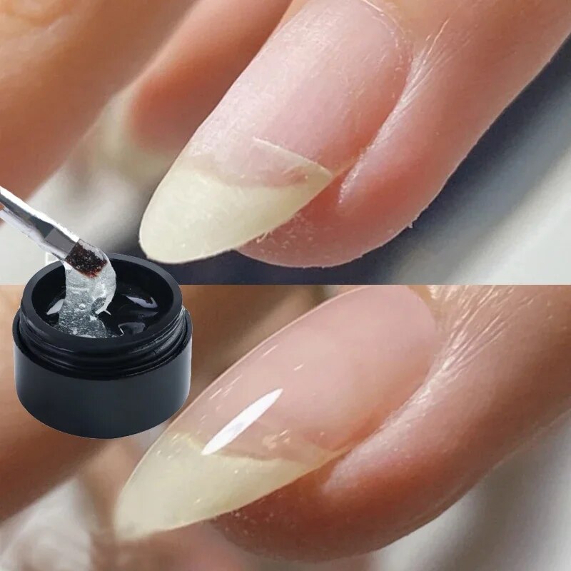 NailFort™ - Nail Repair - 1+1 FREE