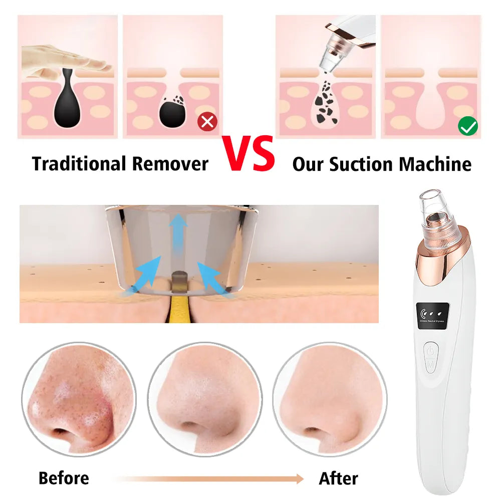 Glamvac Cleaner™ - Skin care and rejuvenation