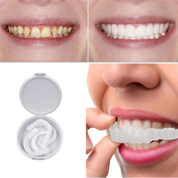 HappySmile™ Brace Simulation Dentures | 50% off