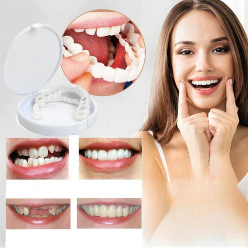 SmileFix™ Create the perfect teeth | ONLY TODAY 1 + 1 FREE